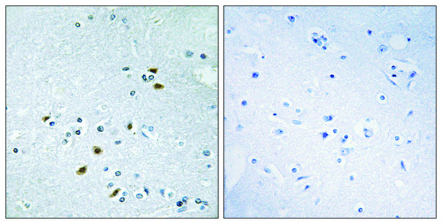 Anti-BRCA2 antibody produced in rabbit