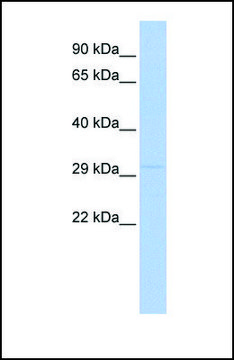 Anti-LYPD4, (N-terminal) antibody produced in