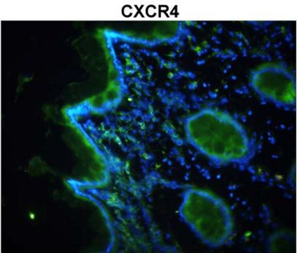 Anti-CXCR4 (N-terminal) antibody produced in