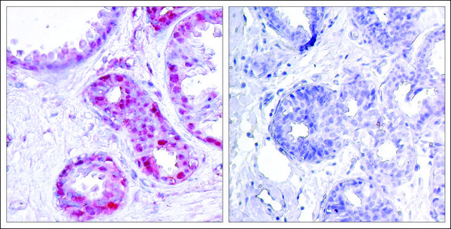 Anti-phospho-JUN (pSer²?³) antibody produced in
