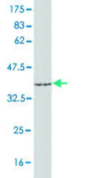 Monoclonal Anti-ACSL1 antibody produced in