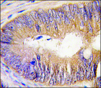 Anti-TASP1 N-term antibody produced in