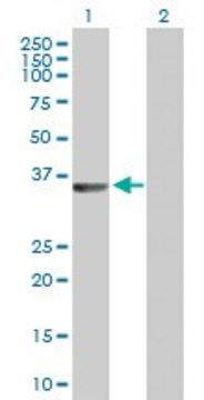 Anti-RLBP1 antibody produced in rabbit