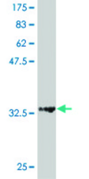 ANTI-HD antibody produced in mouse