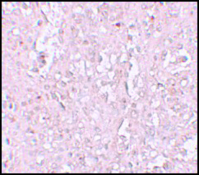 Anti-ZIP13 antibody produced in rabbit