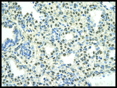 Anti-PATZ1 antibody produced in rabbit