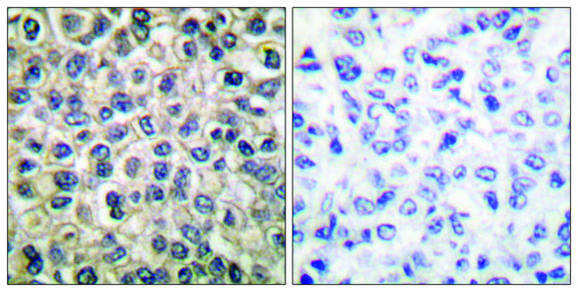 Anti-Catenin-? antibody produced in rabbit
