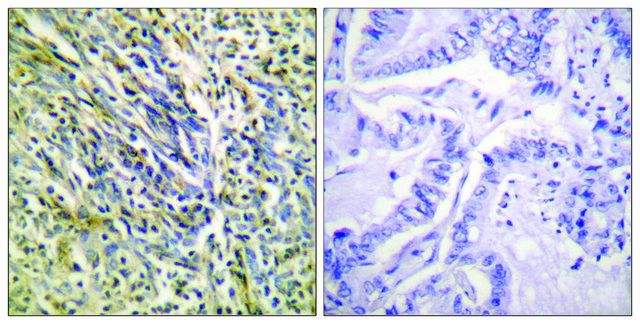 Anti-Aggrecan (Cleaved-Asp³??), N-Terminal antibody produced