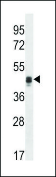 ANTI-CALU(C-TERMINAL) antibody produced in rabbit