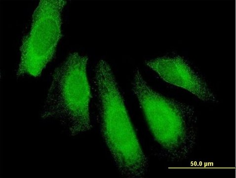 Anti-UBAP1 antibody produced in mouse