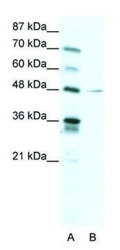 Anti-NFIC (C-terminal) antibody produced in