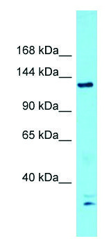 Anti-ERCC5 (N-terminal) antibody produced in