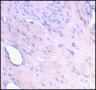 Anti-ARMER antibody produced in rabbit