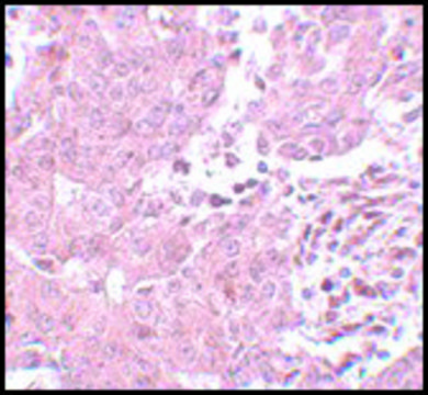 Anti-BCAS3 antibody produced in rabbit