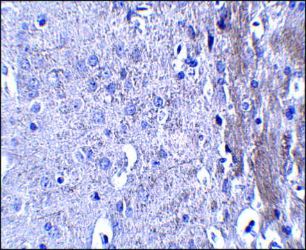 Anti-MATN4 antibody produced in rabbit
