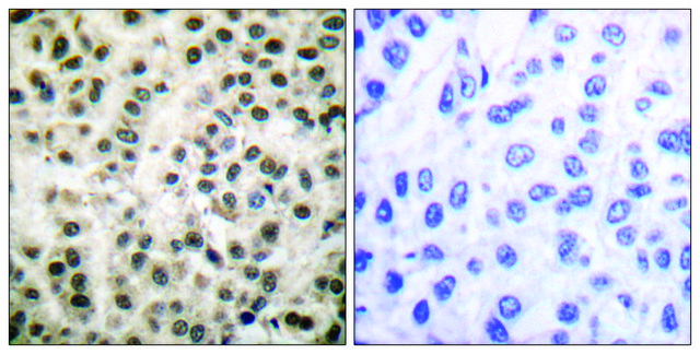 Anti-MEF2A antibody produced in rabbit