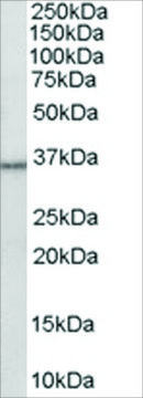 Anti-HSD11B1/HDL antibody produced in goat