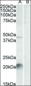 Anti-Klk6 (C-terminal) antibody produced in