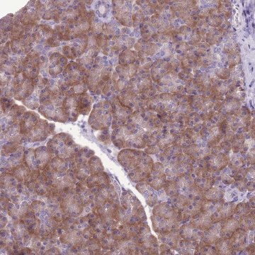 Anti-RPS11 antibody produced in rabbit