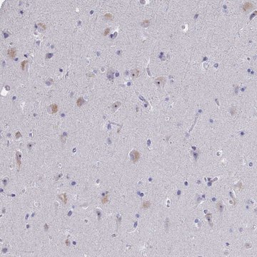Anti-NOXRED1 antibody produced in rabbit