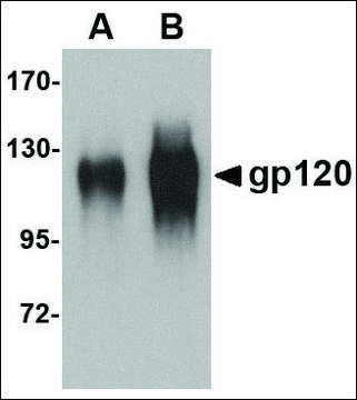 Anti-gp120 antibody produced in goat