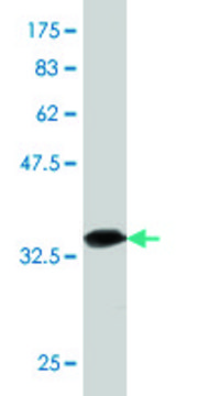 Monoclonal Anti-LIPF, (C-terminal) antibody produced