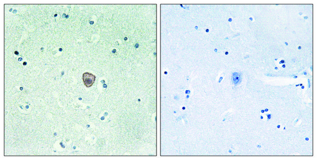 Anti-EDG8 antibody produced in rabbit