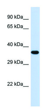 Anti-TOB2 antibody produced in rabbit