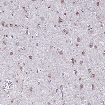 Anti-TMEM106B antibody produced in rabbit