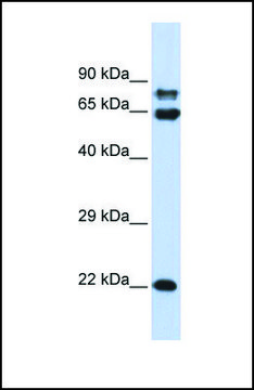 Anti-PPP2R1A, (N-terminal) antibody produced in