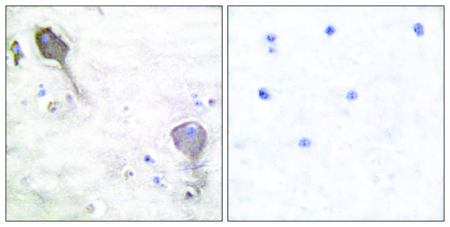 Anti-Parkin antibody produced in rabbit