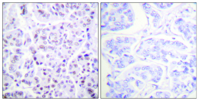 Anti-Histone H4 (Acetyl-Lys?) antibody produced