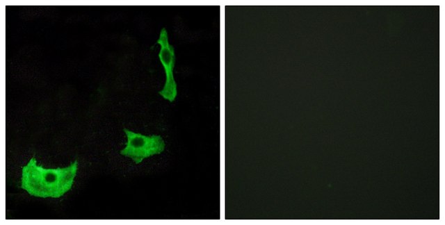 Anti-GPR17 antibody produced in rabbit