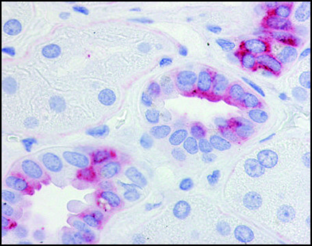 Anti-PTGER2 (AB2) antibody produced in