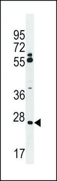 ANTI-CNPY3(N-TERMINAL) antibody produced in rabbit