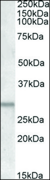 Anti-ATF5 (C-terminal) antibody produced in