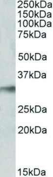 Anti-NEK7 (C-terminal) antibody produced in