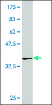 ANTI-LBX1 antibody produced in mouse