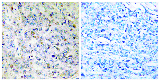 Anti-PDIK1L antibody produced in rabbit