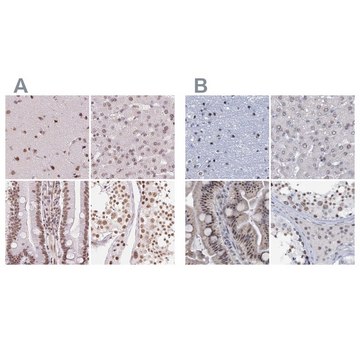 Anti-SREK1 antibody produced in rabbit