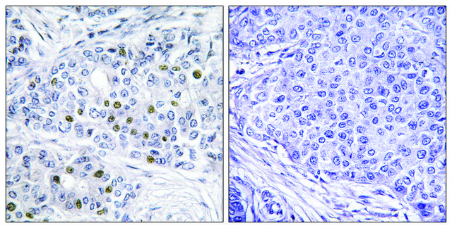 Anti-Retinoblastoma, C-Terminal antibody produced in