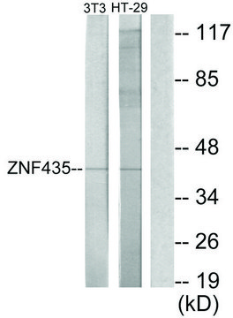 Anti-ZNF435 antibody produced in rabbit