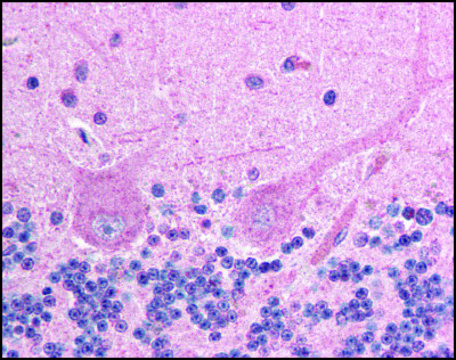 Anti-ING4 antibody produced in goat