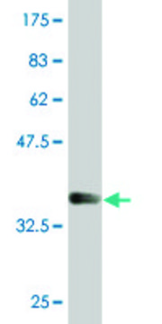 Monoclonal Anti-LSM1, (C-terminal) antibody produced