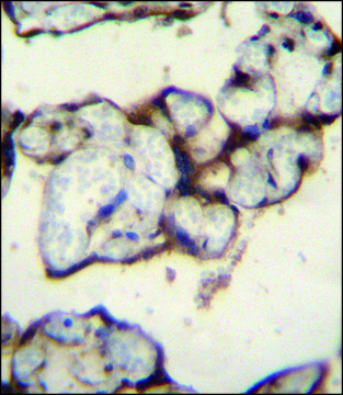 ANTI-PLCXD2 (CENTER) antibody produced in