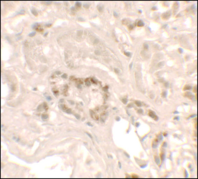 Anti-KANK1 antibody produced in rabbit
