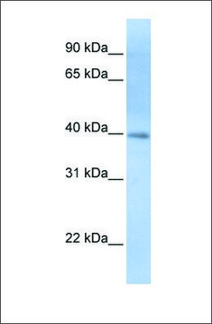 Anti-ITPK1 antibody produced in rabbit