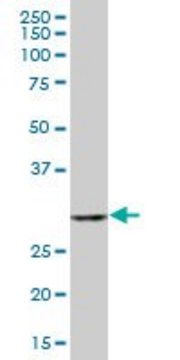 Anti-TBCB antibody produced in mouse