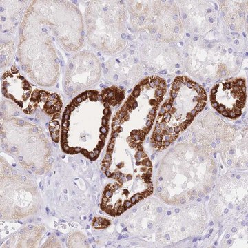 Anti-NKD2 antibody produced in rabbit