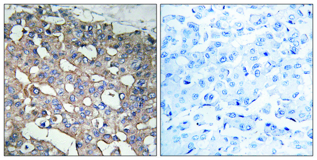 Anti-STMN1 antibody produced in rabbit